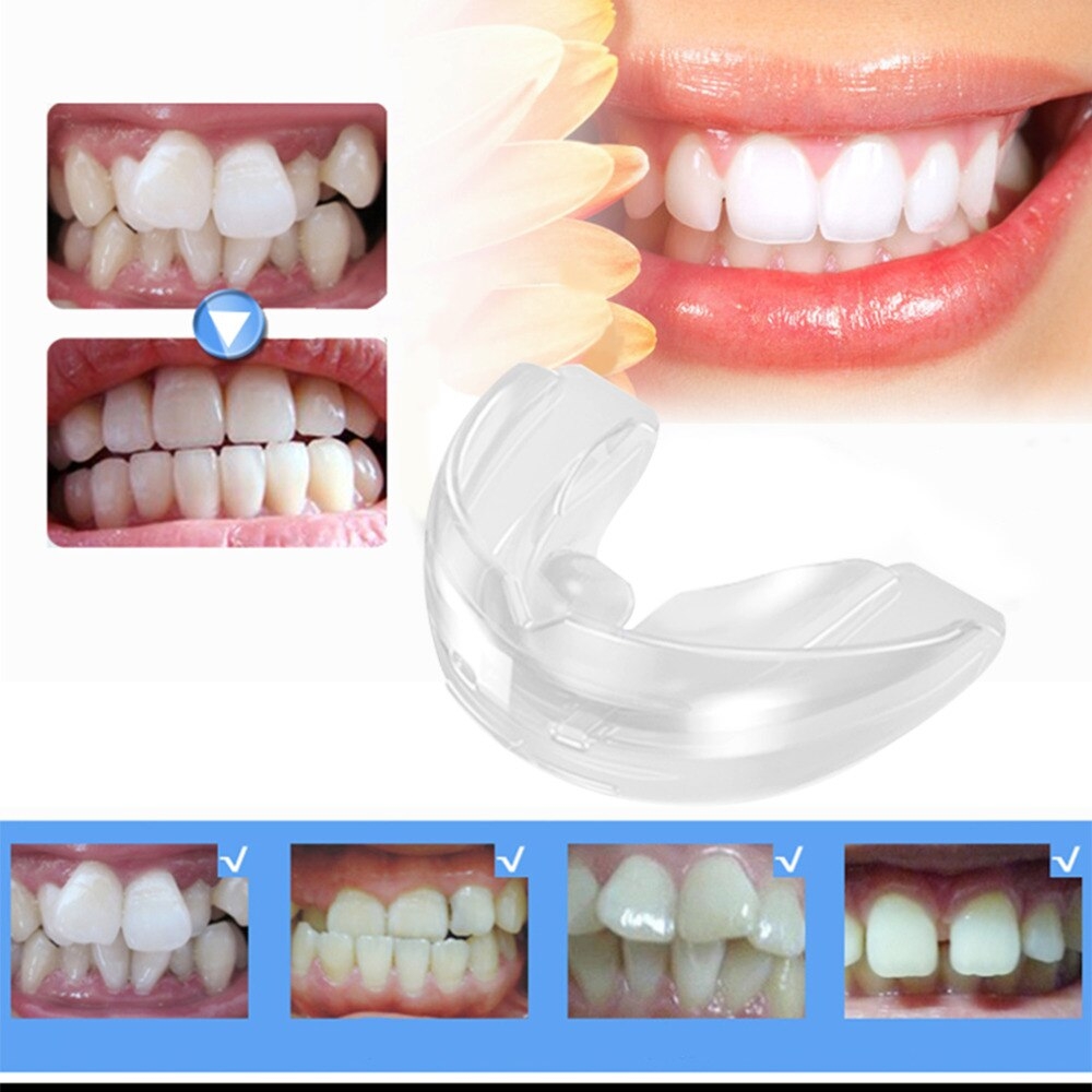 7 Photos Teeth Alignment At Home And Review - Alqu Blog